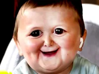 Funny Hasbulla Face image